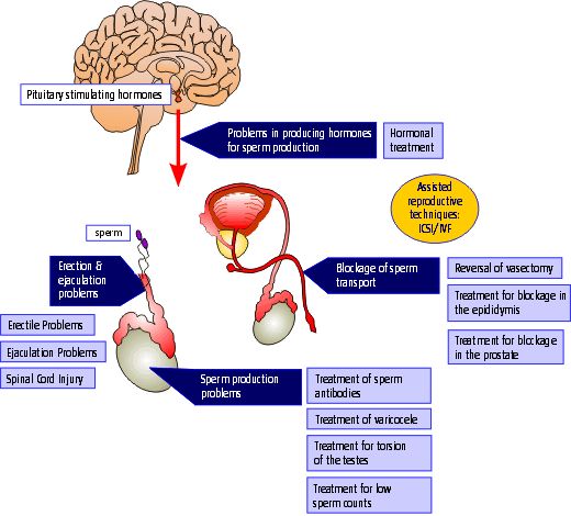 Infertility_MaleInfertility_Treatment