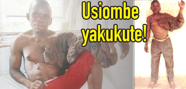 Usiombe yakukute, akumbwa na gonjwa la ajabu - Global Publishers