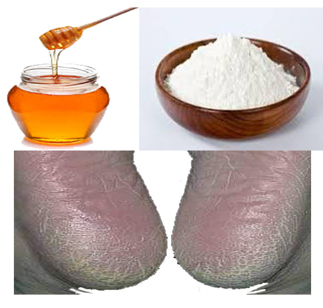 Unga wa mchele na asali unaondoa magaga - Global Publishers