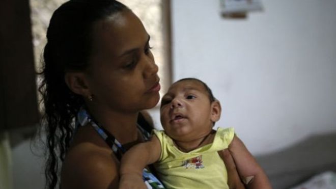 Virusi vya Zika Vyagunduliwa Tanzania - Global Publishers