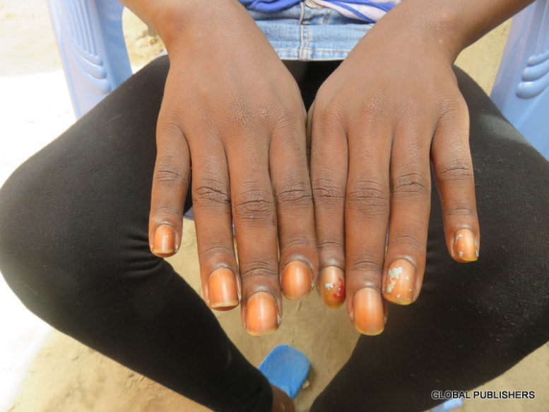 Mtoto wa Unga Aliyeibuliwa na RC Makonda… - Global Publishers