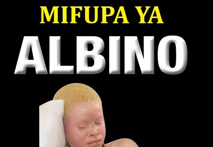 MWANDISHI AANIKA SIRI MAUAJI YA ALBINO KWENYE KITABU - Global Publishers