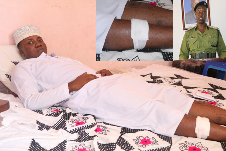 MADAI MAZITO: POLISI AMPIGA RISASI RAIA MWEMA! – VIDEO