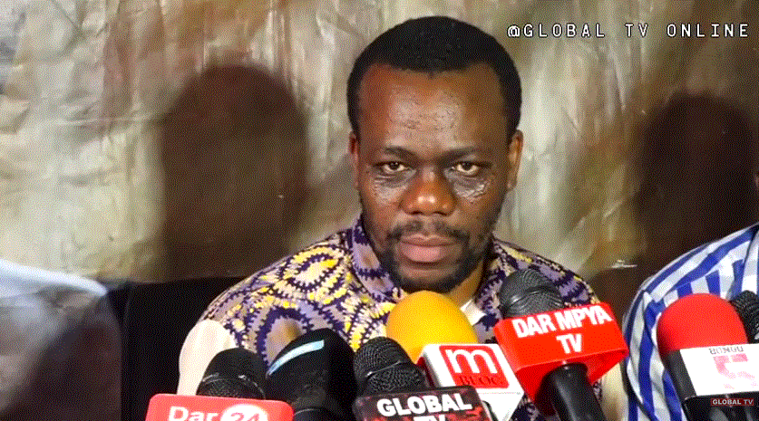 Zitto Adai Hali ya Uchumi Nchini si Nzuri (Video) - Global Publishers