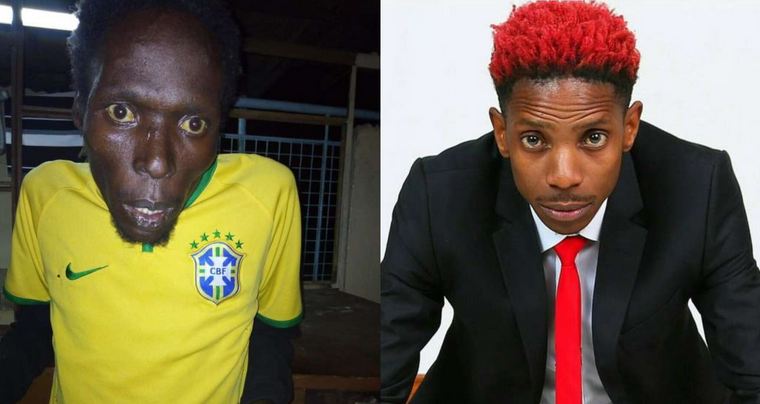 Madawa ya Kulevya Yamuua Kaka’ke Eric Omondi! - Global Publishers