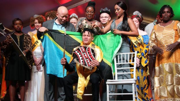 Mtanzania Atunukiwa Ushindi wa Mr Albino Afrika Mashariki 2018 - Global Publishers
