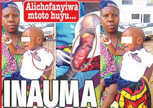 ALICHOFANYIWA MTOTO HUYU… INAUMA MPAKA BASI - Global Publishers
