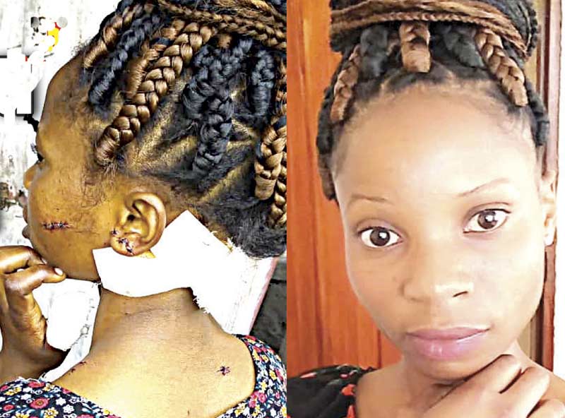 Mrembo achomwa visu akilazimishwa penzi - Global Publishers