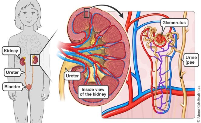 HATARI YA KUHARIBIKA KWA CHUJIO ZA FIGO (GLOMERULONEPHRITIS) - Global Publishers