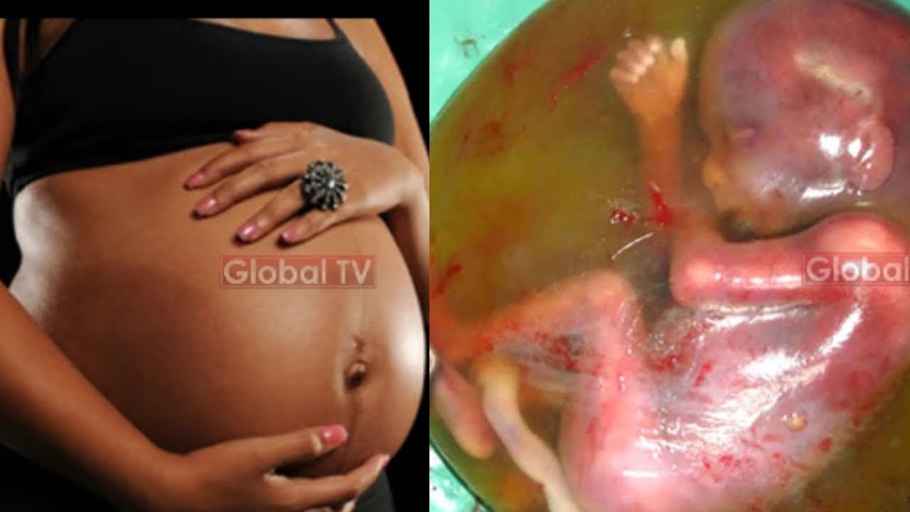 INATISHA! MJAMZITO Ajipasua TUMBO Ajizalishe, RPC Asimulia! – Video - Global Publishers