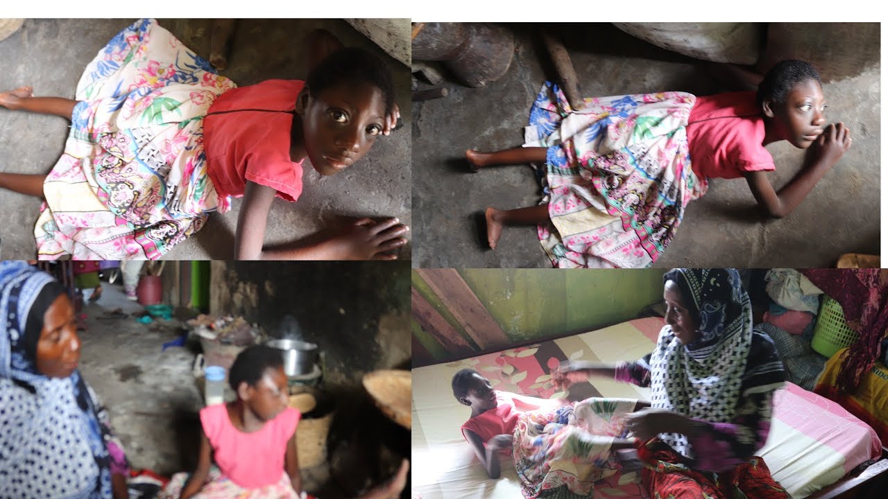 UTALIA: MTOTO Atembea kwa Tumbo, Utamuonea Huruma! – Video - Global Publishers