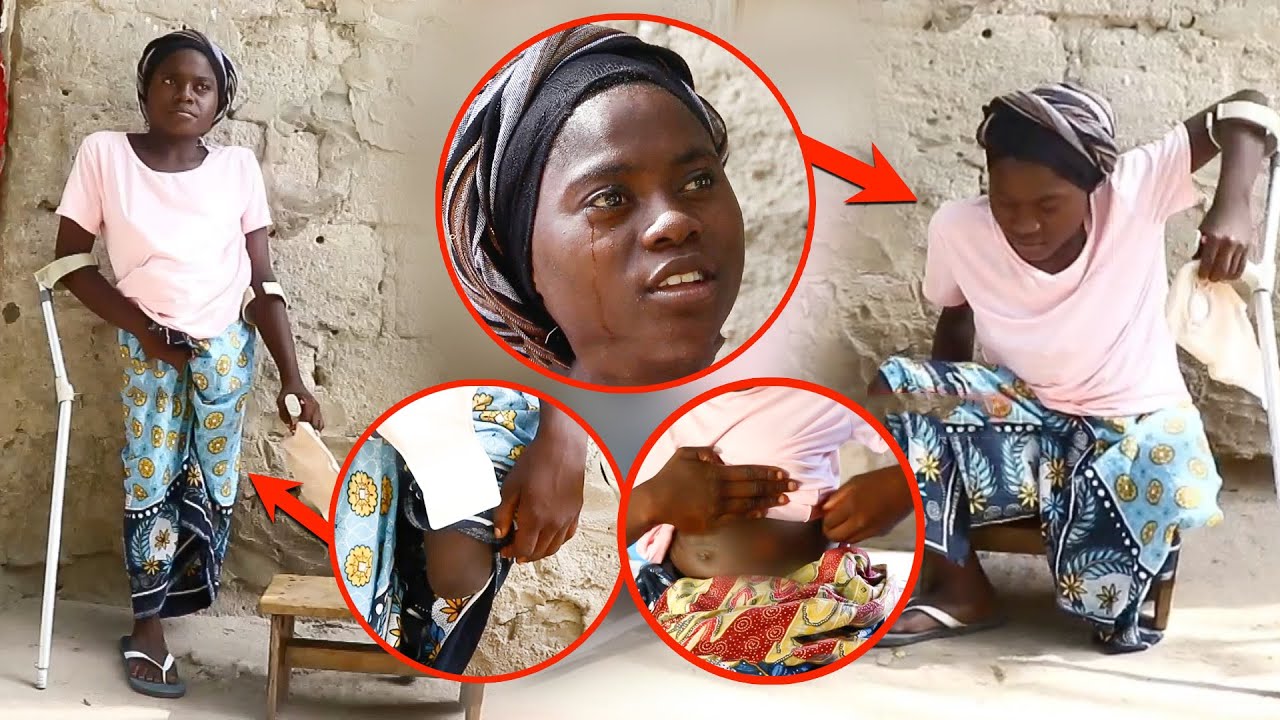 Video: Itakutoa Machozi! Azaliwa Bila Sehemu Ya Haja Kubwa – “Nimekatwa Mguu” - Global Publishers