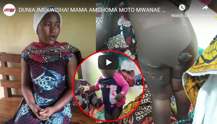 Mama Amchoma Moto Mwanae wa Kumzaa, Kisa Kitakushangaza – Video - Global Publishers