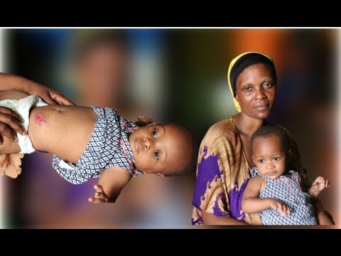 Inasikitisha: Mtoto Atokwa Haja Kubwa Sehemu Zote – Video - Global Publishers