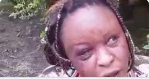 Polisi Yaaingilia Sakata la Mwanamke Anayeidaiwa Kufumaniwa na Mume wa Mtu - Global Publishers