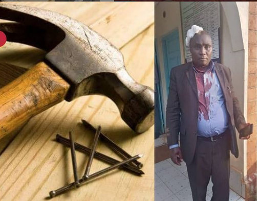 Mwalimu  Achomwa Msumari Kichwani na Mwanafunzi - Global Publishers