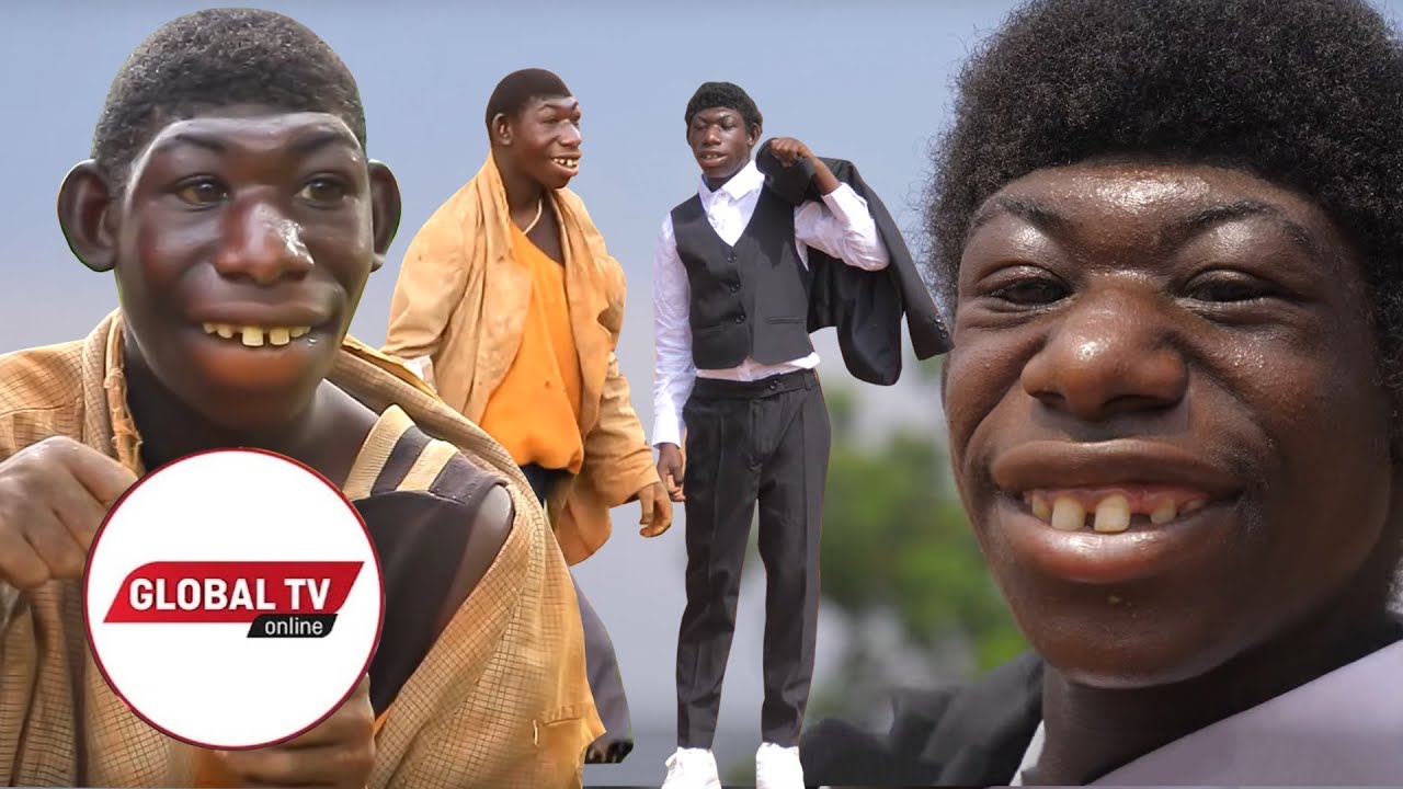 Kijana Aliyefanana Na Sokwe Ageuka Staa Duniani-Video