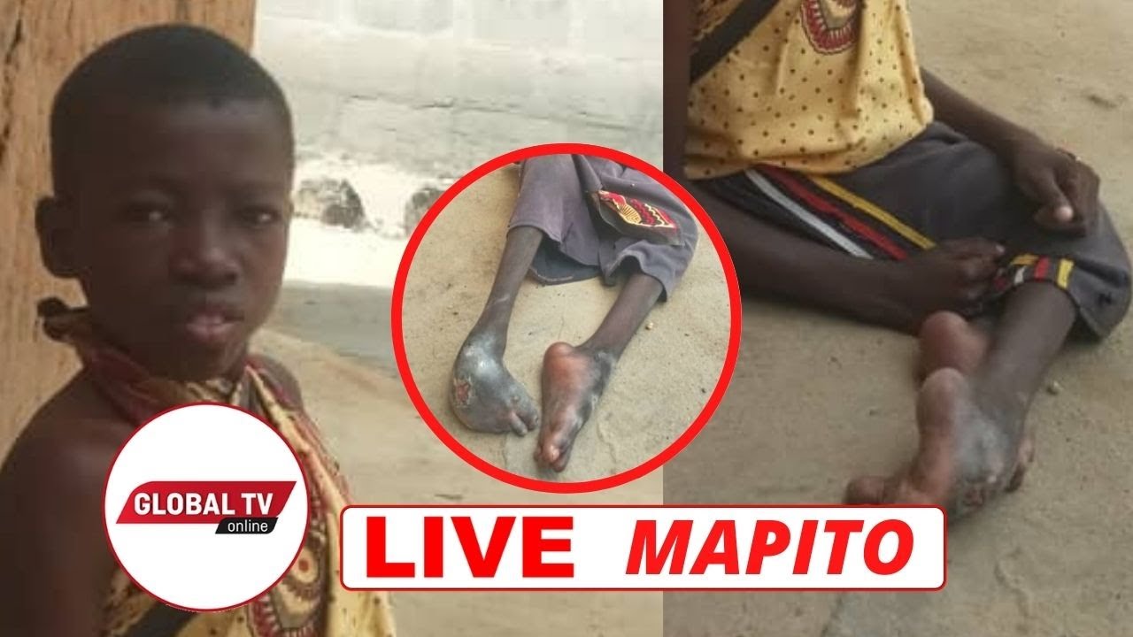 Kijana: “Naishi Miaka 14 Bila Sehemu ya Haja Kubwa”, Atoa Machozi – Video - Global Publishers
