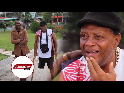 ITAKULIZA: Msanii Bambucha Akatwa Mguu, Asimulia Mateso Aliyopitia – “Wasanii Wenzangu  Wamenitenga” - Global Publishers