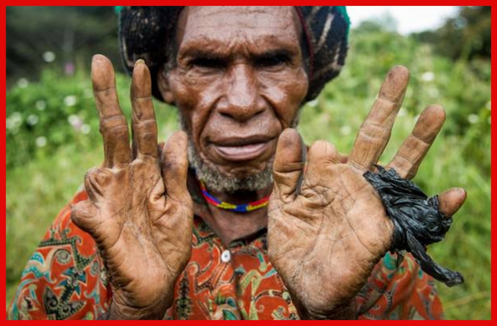 Imefahamika Ukitaka Kuoa au Kutoa Talaka Sharti Ukate Kidole