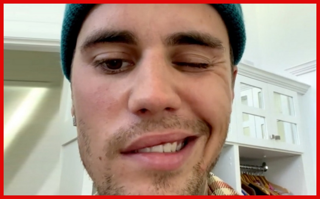 Justine Bieber Athibitisha Kupooza Uso, Aahirisha Shoo Zake - Global Publishers