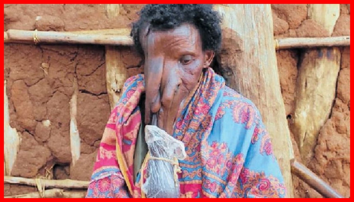 Ugonjwa wa Ajabu Waipa Mateso Familia Babati, Waathiri Familia Nzima - Global Publishers