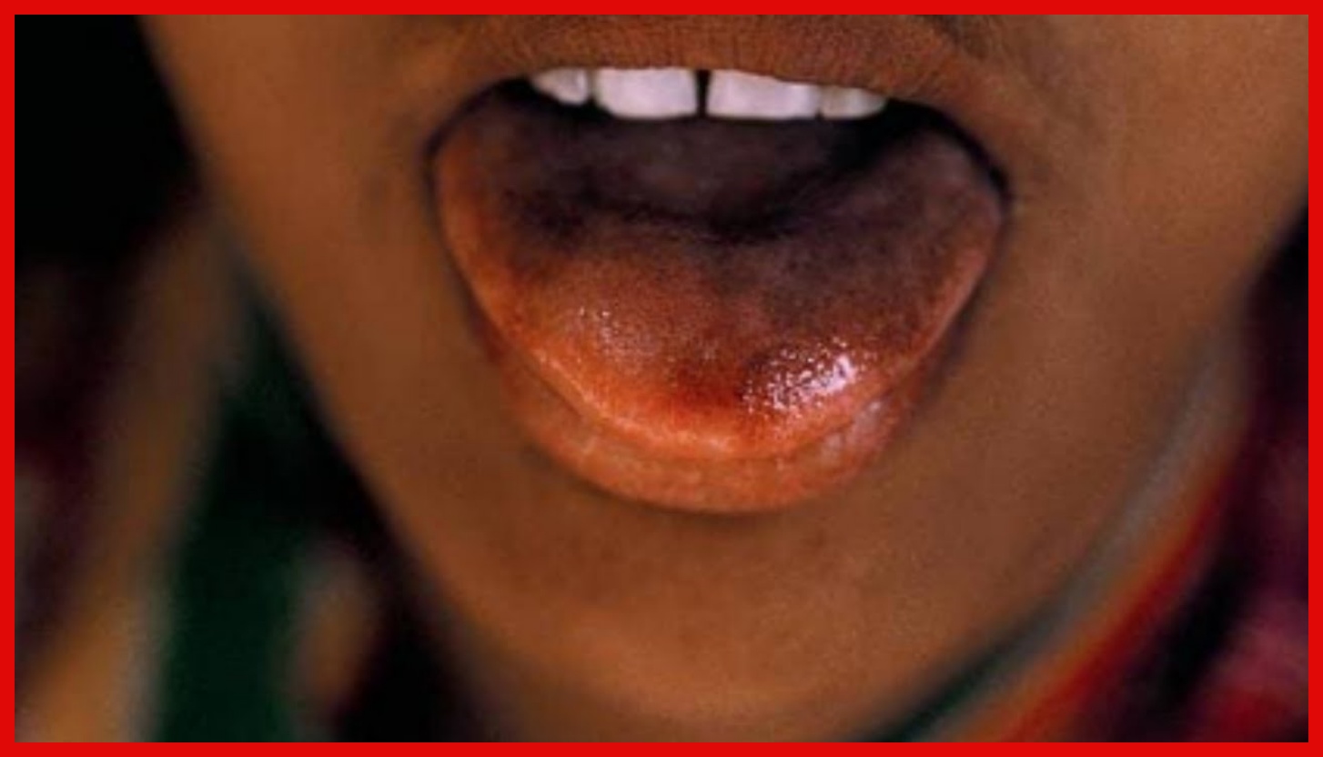 Jamaa Ang’olewa Ulimi Akiwa Kwenye Tendo la Ndoa, Polisi Wathibitisha Tukio - Global Publishers