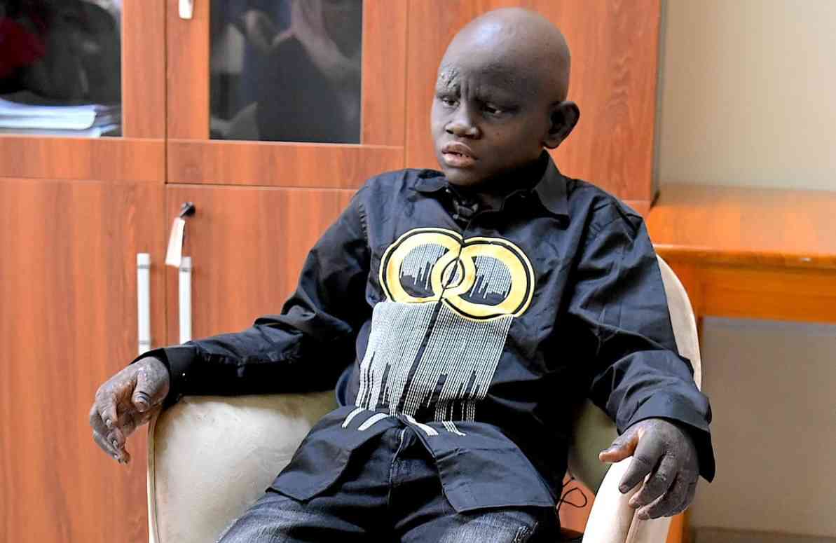 Mtoto alivyowatoroka wazazi usiku kumfuata Rais Samia kuokoa maisha yake - Global Publishers