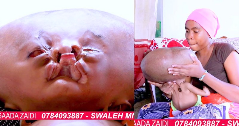 Mateso Ya Mtoto Miezi 6 Yatakuliza, Mama Yake Aomba Msaada – Video - Global Publishers