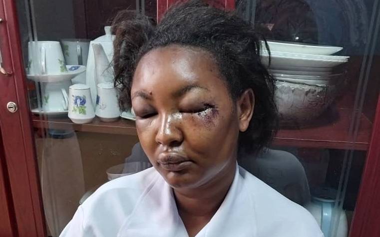 Jeshi la Polisi Lamsaka Mwanaume Aliyemtoboa Jicho Mkewe na Kumng’oa Jino - Global Publishers