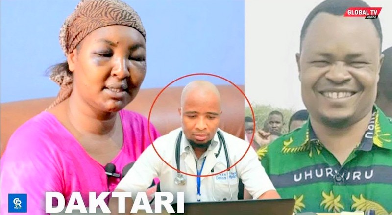 Video: Daktari Akataa Jackline Hajatobolewa Jicho Na Hajang’olewa Meno Na Bisibisi – ”Ni Uvimbe Tu”… - Global Publishers