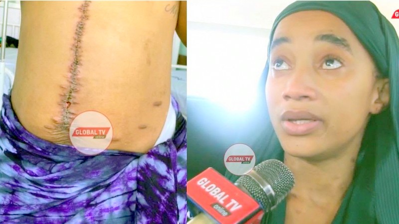 Carina Ashindwa Kutoka katika Hospital ya Rufaa ya Bugando Kisa Deni - Global Publishers