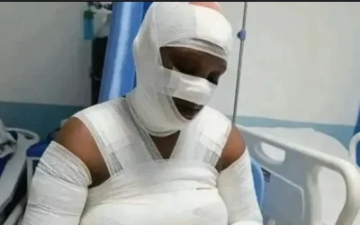 Mwanamke Afariki Baada ya Kushambuliwa kwa Petroli Nairobi - Global Publishers