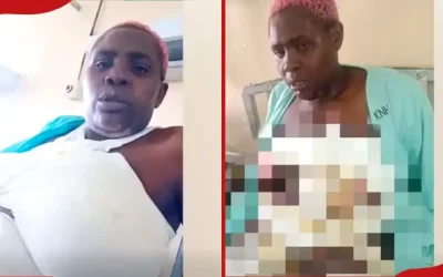 Polisi Wachunguza Tukio la Mwanamke Kumwagiwa Maharagwe ya Moto, Familia Yafunguka - Global Publishers