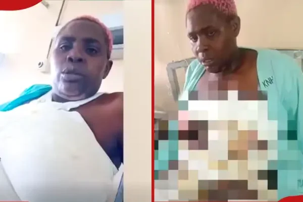 Polisi Wachunguza Tukio la Mwanamke Kuchomwa Maharagwe ya Moto