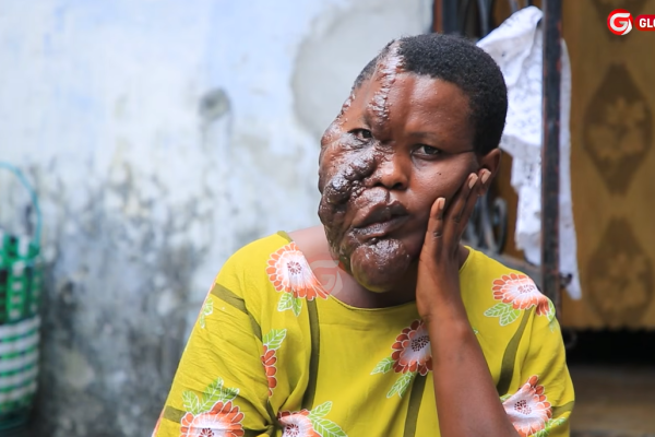 Aishi na Uvimbe Miaka 20 Aomba Msaada wa Matibabu, Afunguka Mazito -Video
