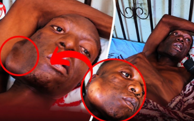 Mkazi wa Goba Aomba Msaada Baada ya Kushindwa Kutembea na Kukaa – Video - Global Publishers