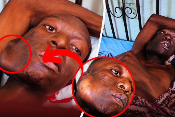 Mkazi wa Goba Aomba Msaada Baada ya Kushindwa Kutembea na Kukaa – Video